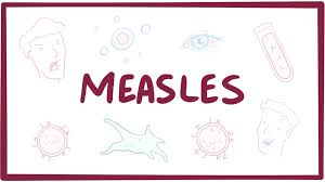 Measles epidemic registered in many regions of the world