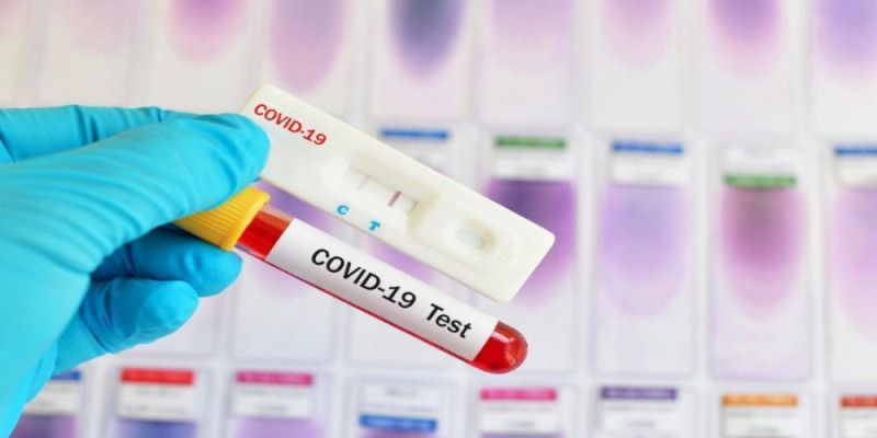 80% of COVID-19 cases revealed in time of screening over past week - Health Care Ministry