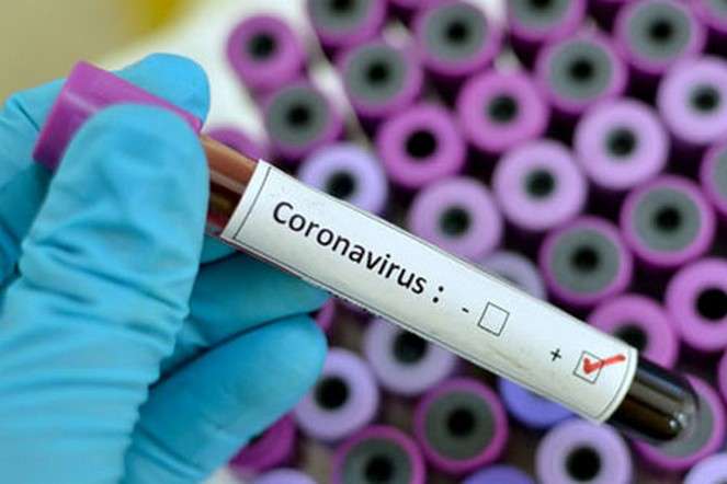 14 новых случаев коронавируса зарегистрированы в Нур-Султане