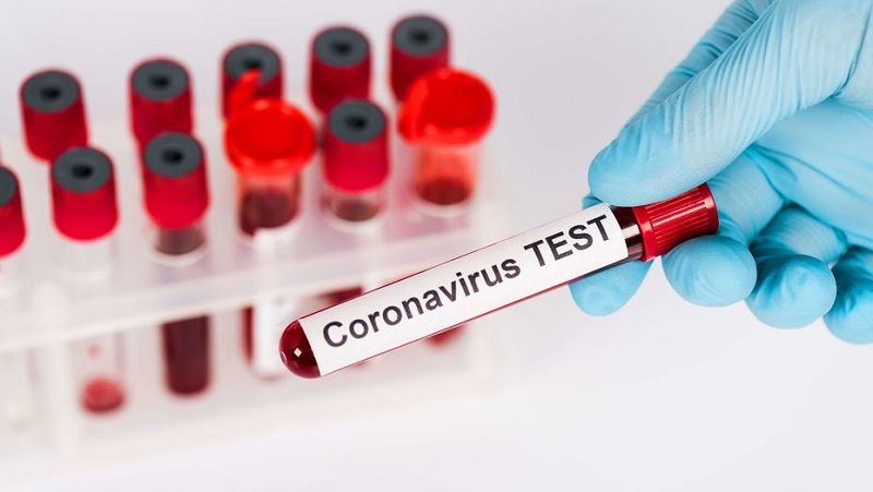 Число заразившихся коронавирусом в Казахстане достигло 16 351 