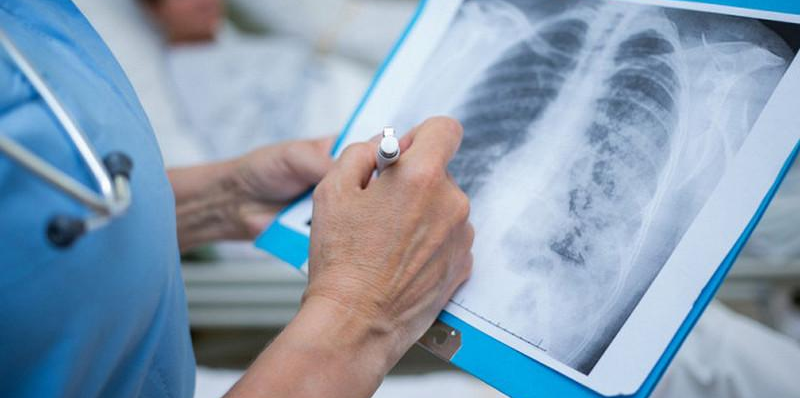 Число зараженных пневмонией с признаками COVID-19 в Казахстане превысило 30 тыс.
