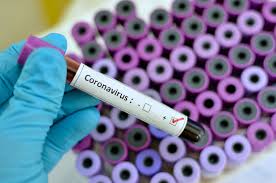 Fear of coronavirus pandemic grows but China eases curbs as new infections fall
