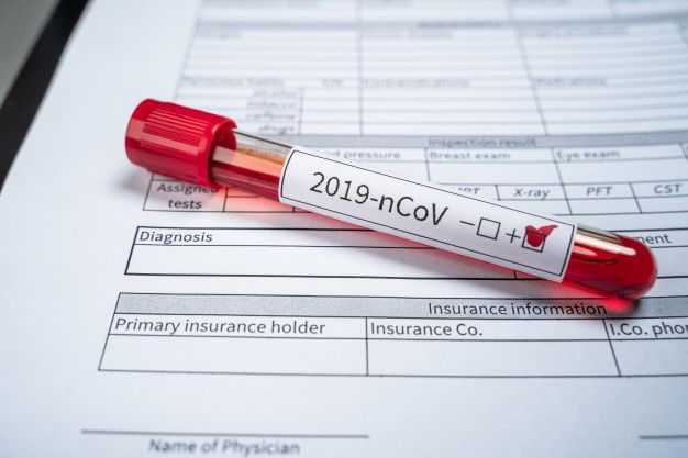 78 новых заболевших COVID-19 зарегистрировано за прошедшие сутки в Казахстане – Биртанов