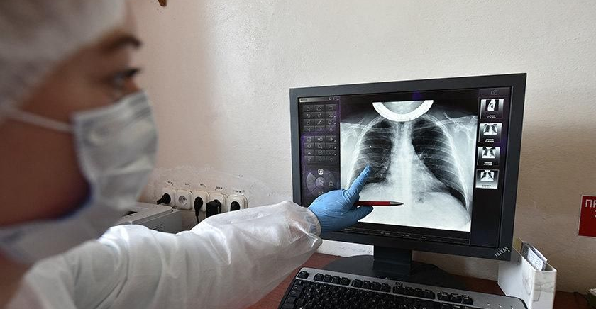 Систему раннего выявления пневмонии с признаками КВИ внедрили в Алматинской области