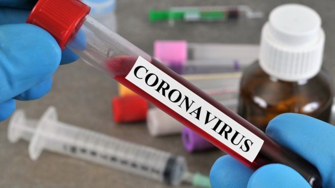 438 new coronavirus cases revealed in Kazakhstan 