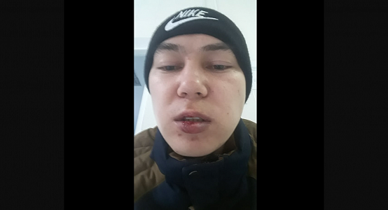 Activist from Uralsk: Policeman in time of detention hit me with his head and smashed my lips