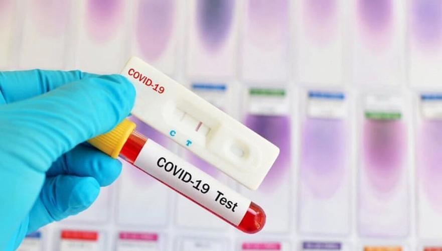 Почти Т1 млрд на закуп 1,2 млн тестов на COVID-19 выделило правительство РК – Цой