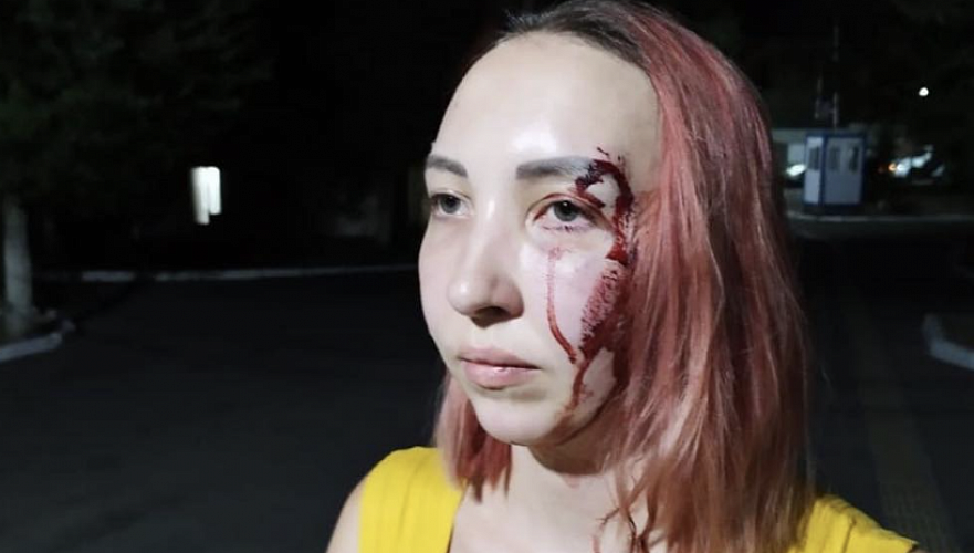  Прохожий мужчина избил девушку на улице в Алматы
