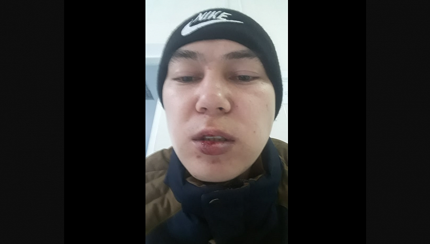 Активист из Уральска: Полицейский при задержании ударил меня головой и разбил мне губы