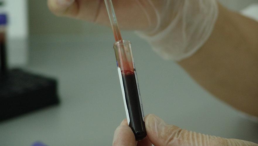 Троих ВИЧ-пациентов выявили в центральной горбольнице Алматы