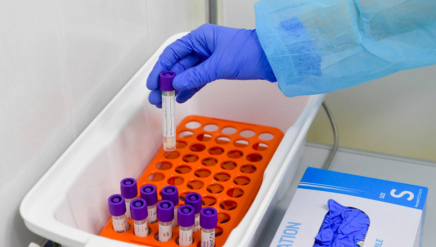 Тесты на коронавирус были закуплены в рамках процедуры разового ввоза – минздрав РК