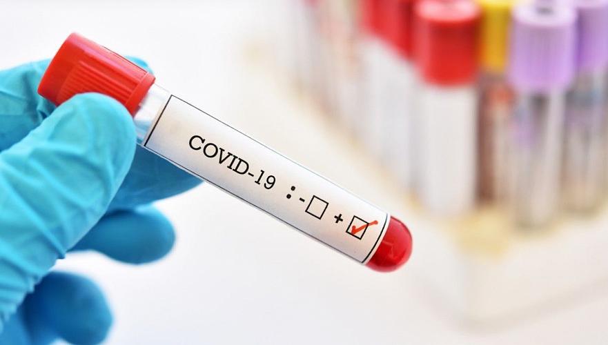 6341 случаев COVID-19 и КВИ-пневмонии выявили в Казахстане за 21-22 августа