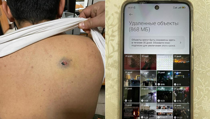 Задержанному узбекистанцу с пулевым ранением вменяют участие в беспорядках в Шымкенте